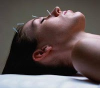 Kirsten Sturman Acupuncture and Massage 721745 Image 4